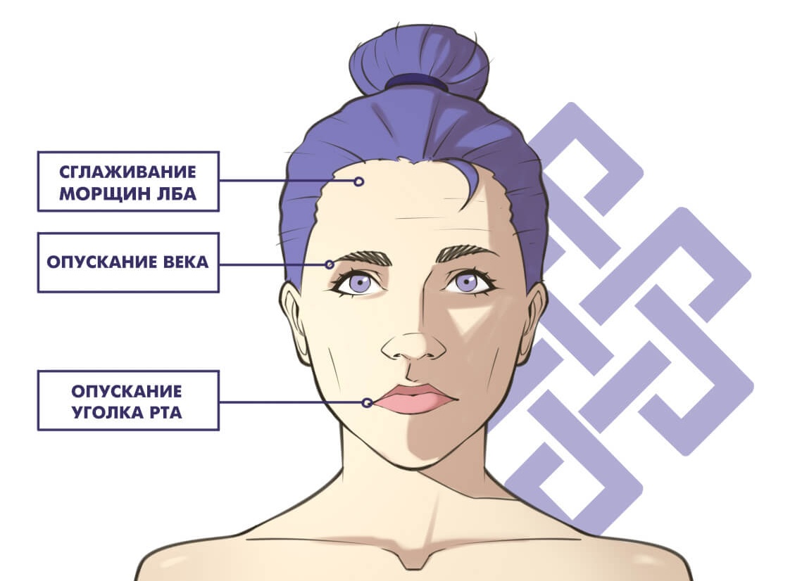 Симптомы неврита тройничного нерва, их причины и лечение