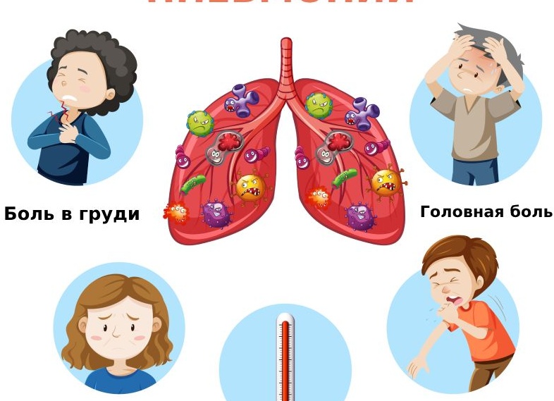 Пневмония: симптомы и лечение воспаления легких