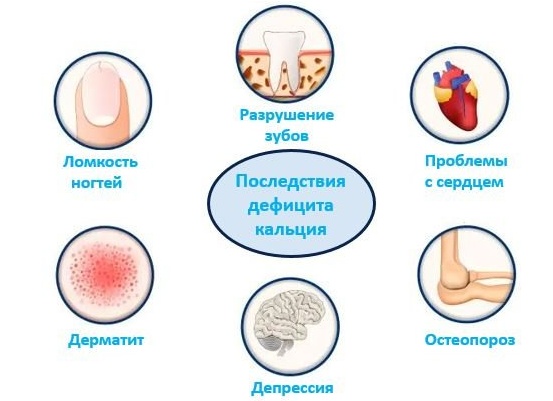 Недостаток кальция в организме (Гипокальциемия): симптомы и последствия