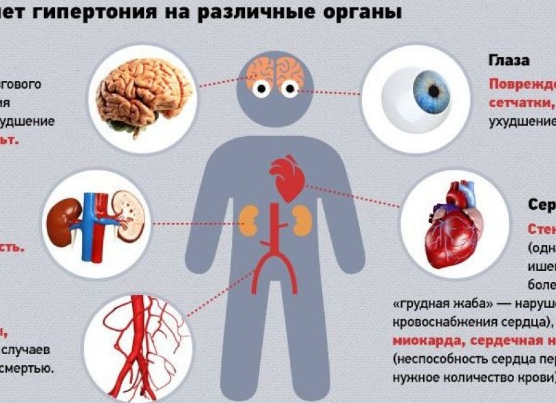 Гипертензия или высокое давление. Приичины, симптомы и их лечение