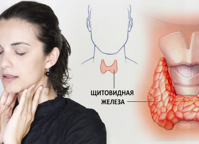 Все о заболевании щитовидной железы. Причины, симптомы, лечение