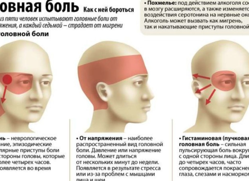 Мигрень и сетчатка: могут ли головные боли указывать на проблемы со зрением?