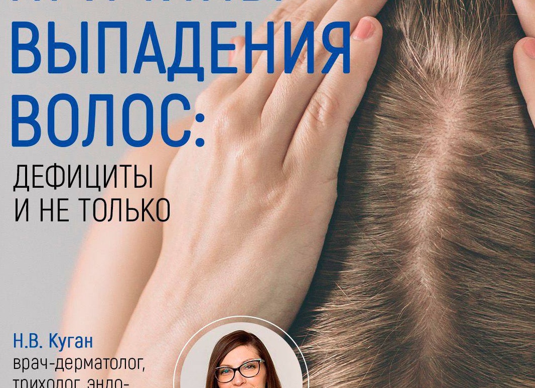 Причины выпадения волос и витамины от облысения