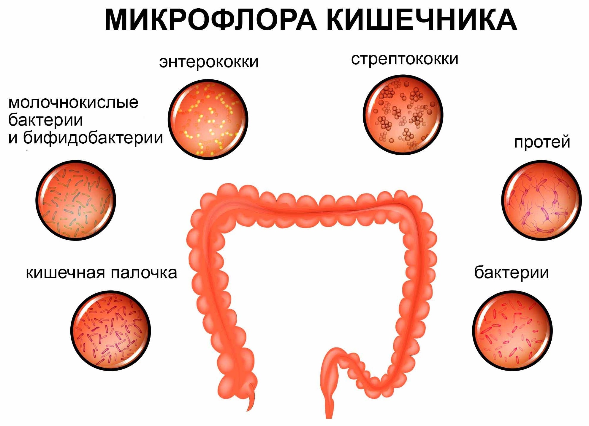 Дисбактериоз кишечника – симптомы, лечение, анализы и диета