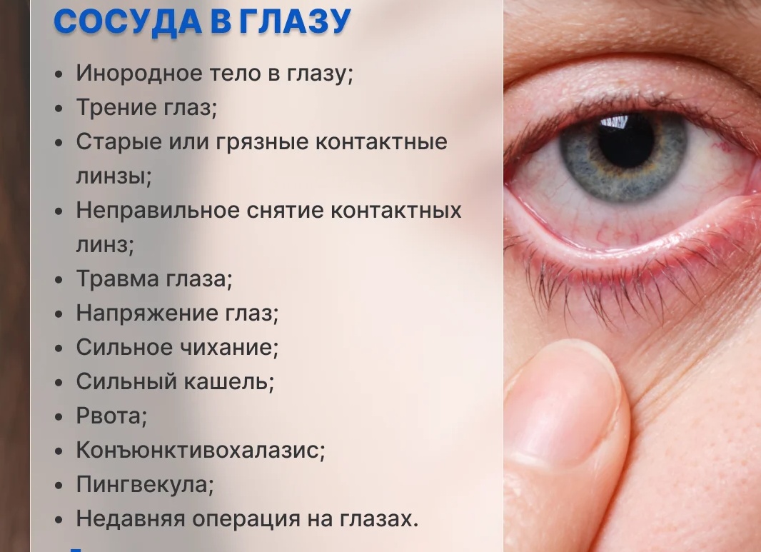В глазу лопнул сосуд: что капать для коррекции симптома