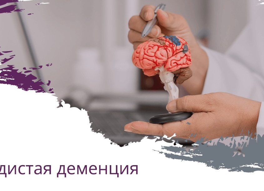 Деменция: Причины, симптомы, диагностика и лечение.