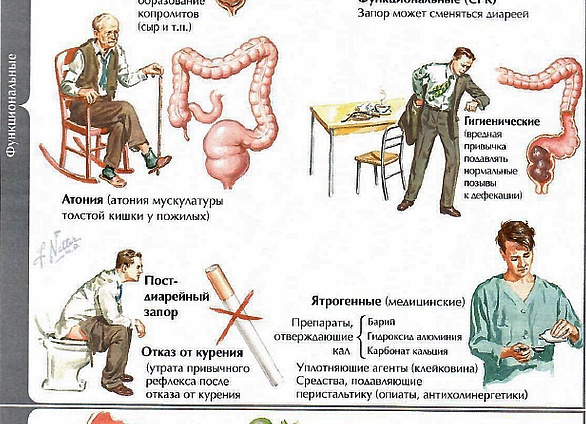 Запоры: причины, последствия, заболевания и методы лечения