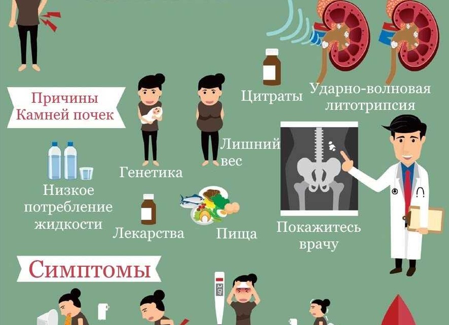 Мочекаменная болезнь у мужчин. Причины и симптомы и лечение