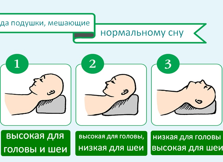 Что делать если болит шея и невозможно повернуть голову?