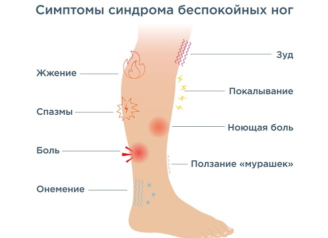 Синдром беспокойных ног: причины, симптомы и цели лечения