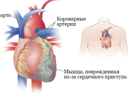 7 болезней, которые не могут объяснить даже врачи