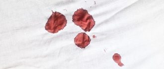 Кровь на постеле